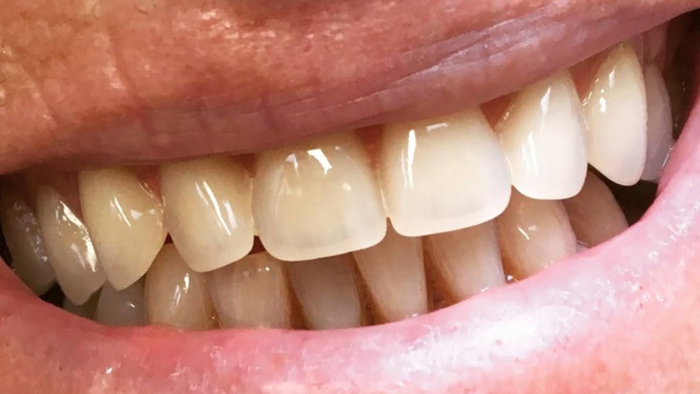Klinisk Tandtekniker v. Michelle og Madura Tandtekniker - Klinisk, Haderslev - 4