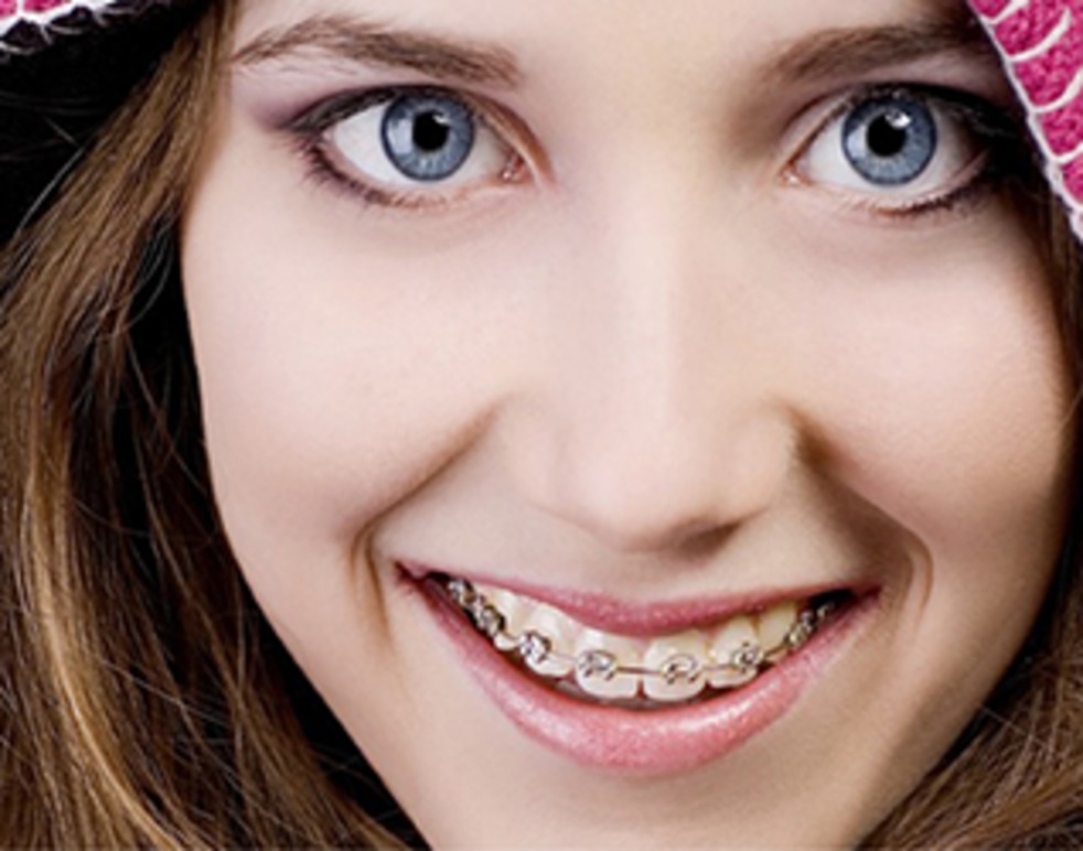 Prime Ortodonti AB - Tandreglering Nacka Tandläkare, Nacka - 4