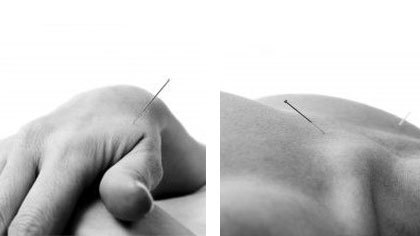 PUNKT & PRIKKE akupunktur Akupunktør, Aarhus - 3