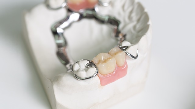 Klinisk Tandtekniker - Det Naturlige Smil ApS Tandlæge, Hjørring - 5